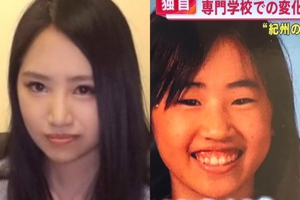 須藤早貴の顔の変化がやばい 整形したポイント5つ 高校生の頃から変わっている Basement Picks